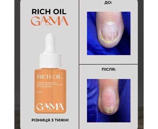 GaMa Rich oil Живильна олійка для інтенсивної регенерації нігтів, 10 ml #2