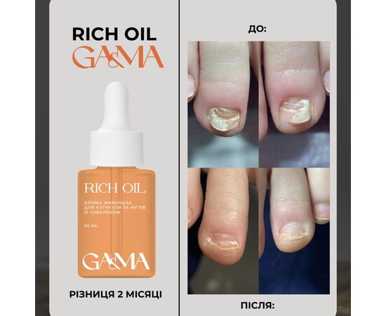 GaMa Rich oil Живильна олійка для інтенсивної регенерації нігтів, 10 ml #4
