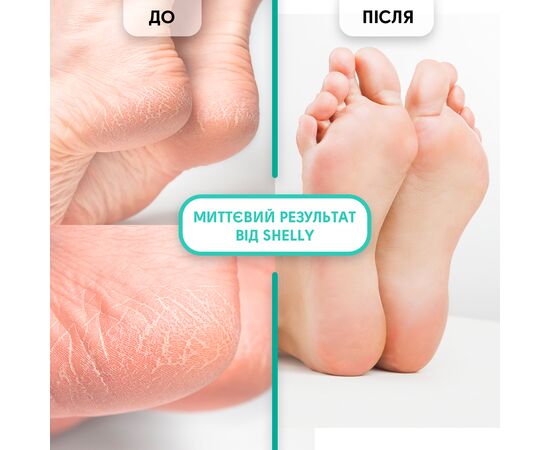SHELLY. Keratolytic gel for removing calluses, Soft blade, 200 ml. Гель-кератолітик для видалення мозолів і натоптишів "М'яке лезо" #3