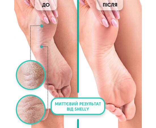 SHELLY. Spa-bath for faster preparation for manicure and pedicure, Soft blade, 500 ml. Спа-ванна для прискореної підготовки до манікюру і педикюру "М'яке лезо" #4