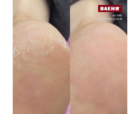 BAEHR, DEER TALLOW FOOT CREAM, 125 ml, Крем для стоп з 100%  оленячим жиром #3