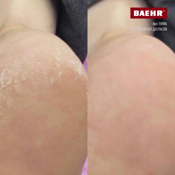 BAEHR, DEER TALLOW FOOT CREAM, 125 ml, Крем для стоп з 100%  оленячим жиром #3